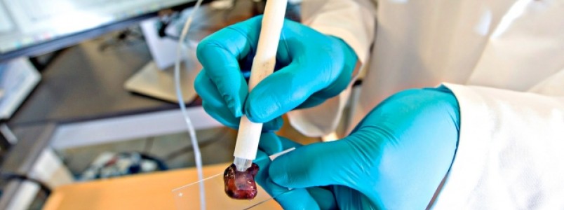 Cientistas criam sonda que rastreia células cancerosas em apenas 10 segundos